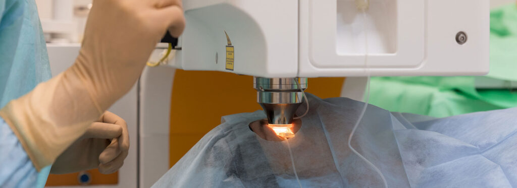 lasik and femto sbk technology