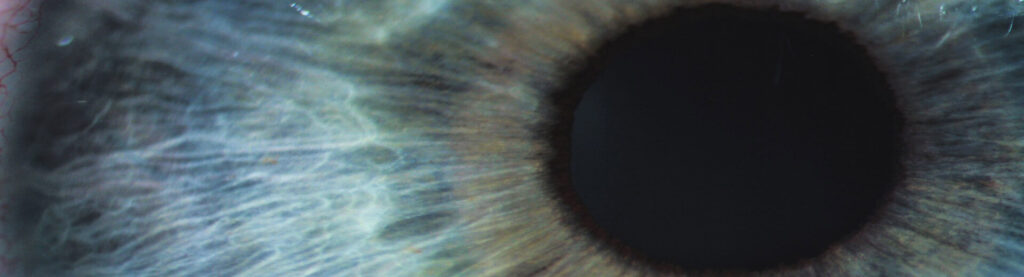 causes of low vision are you at risk