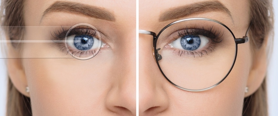 choosing between lasik and prk