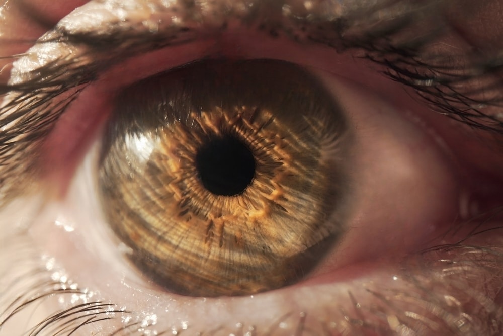 the power of refractive lens exchange seeing beyond limits
