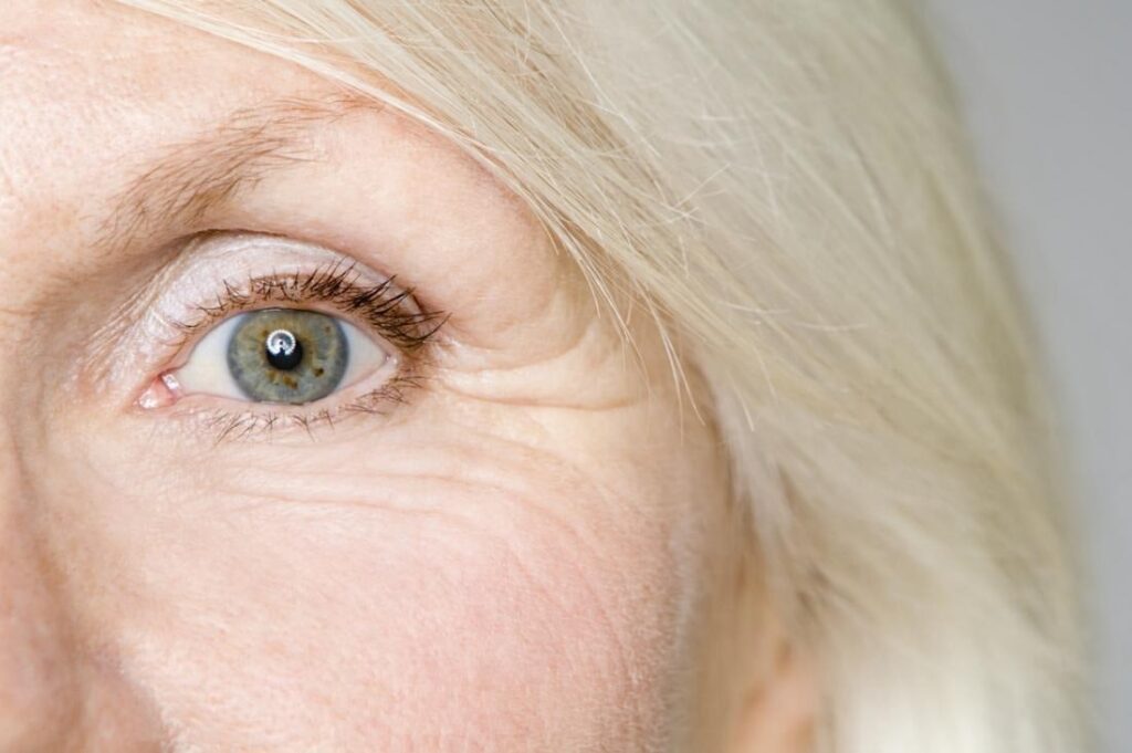 Age-Related Eye Issues You Should Know About