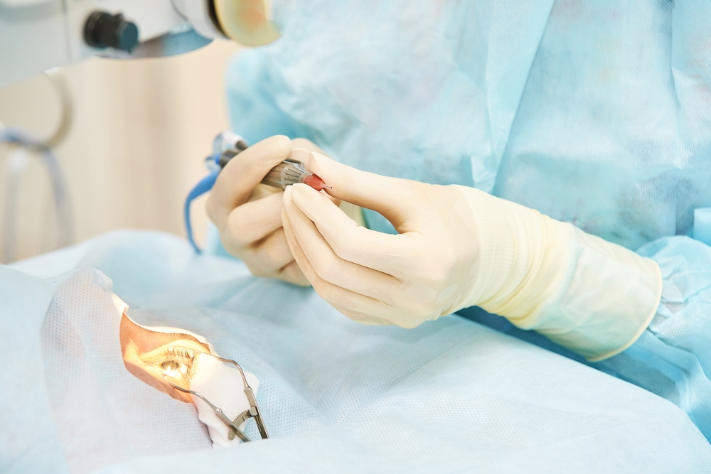 PRK Surgery LP1