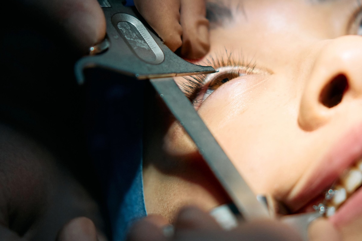 LASIK Recovery Timeline - What to Expect
